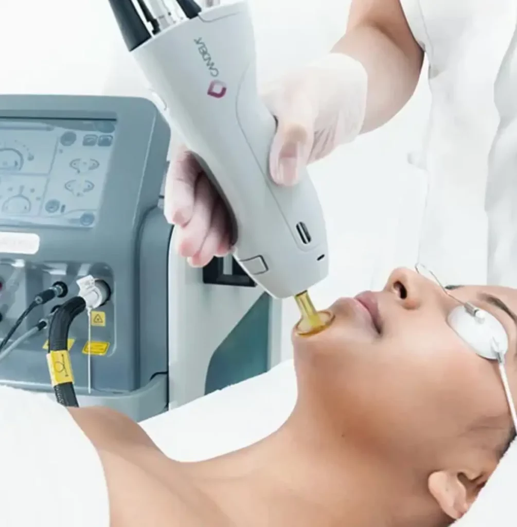 a woman receiving a laser treatment